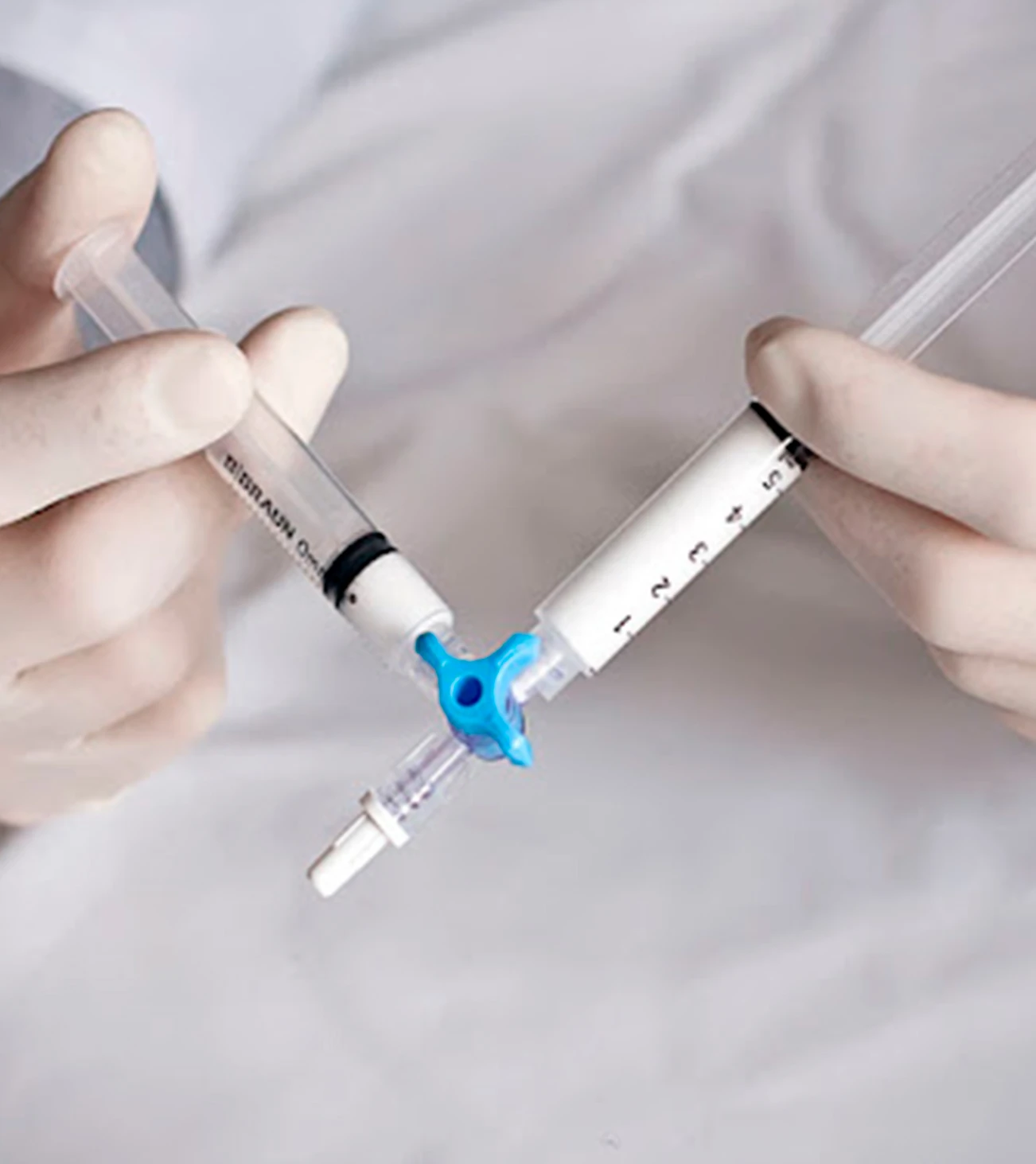 Escleroterapia con microespuma